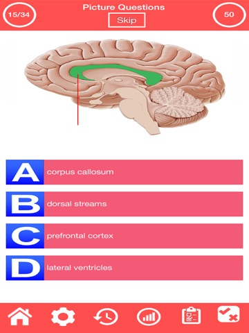 Nervous System Quiz screenshot 2