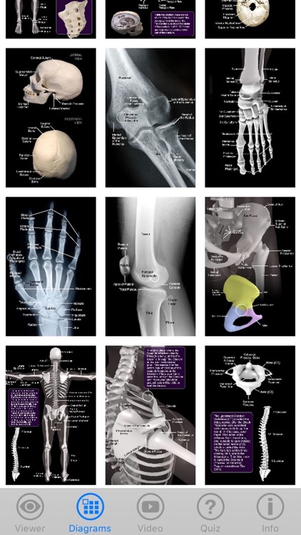 Skeletal Anatomy 3D - Quiz and Reference screenshot-3