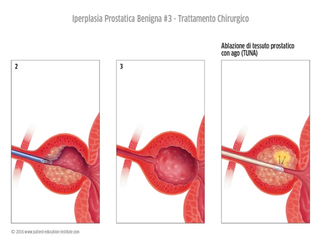 SIU, Urologia, tablet app(圖3)-速報App