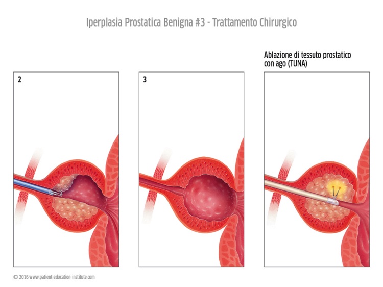 SIU, Urologia, tablet app