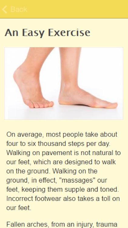 Symptoms Of Fallen Arches