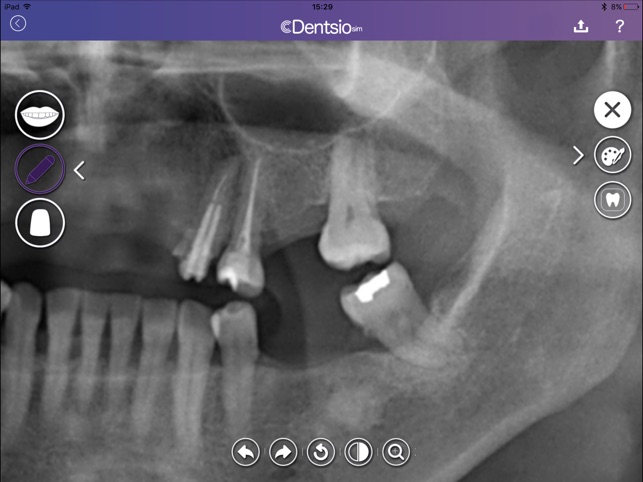 DentsioSim(圖5)-速報App