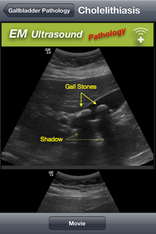 Emergency Medicine Ultrasound screenshot 3