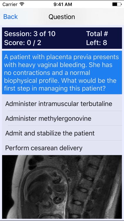 Maternal Newborn Nurse MNN Review