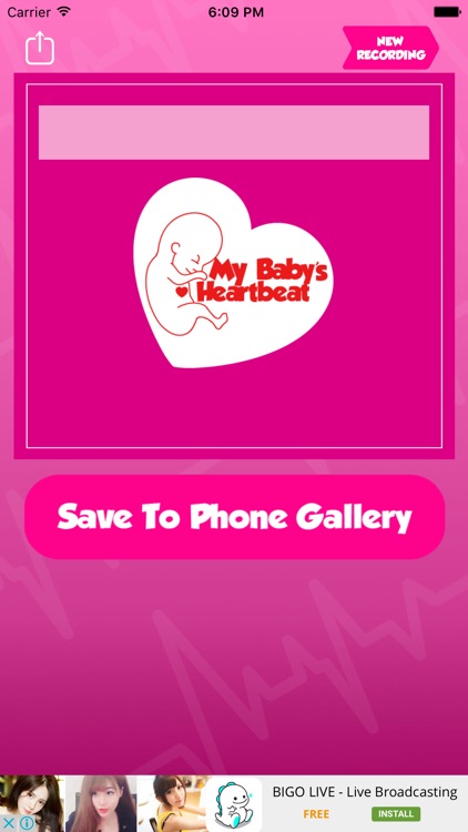 My Baby's heartbeat - Prenatal Listener
