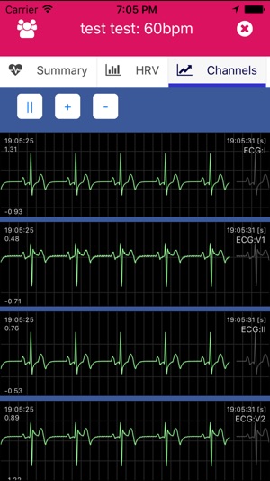 VitalScan(圖4)-速報App