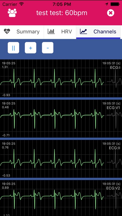 VitalScan screenshot-3