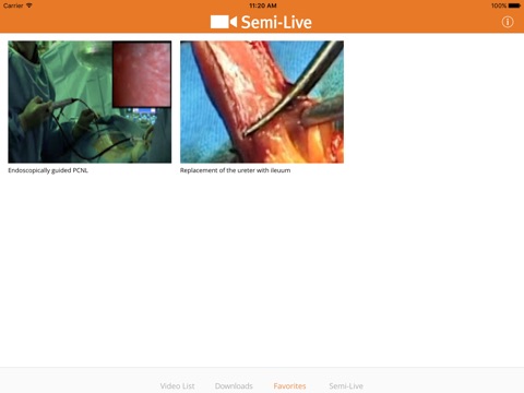 Semi-Live screenshot 3