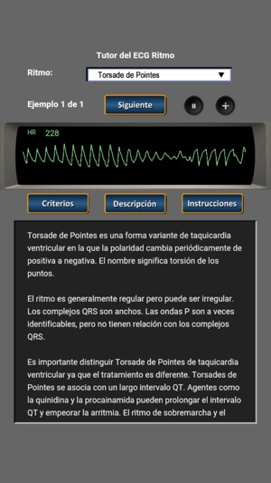 Tutor del ECG Ritmo(圖4)-速報App