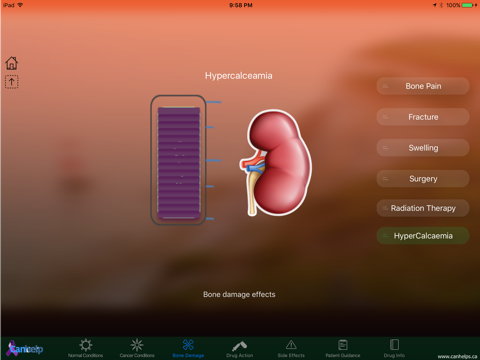 Denosumab screenshot 3