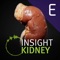 This version of INSIGHT KIDNEY for Enterprise REQUIRES an Enterprise License