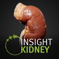 INSIGHT KIDNEY Erfahrungen und Bewertung