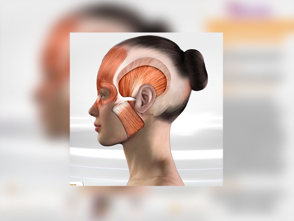 Chronic Migraine Anatomy screenshot 2