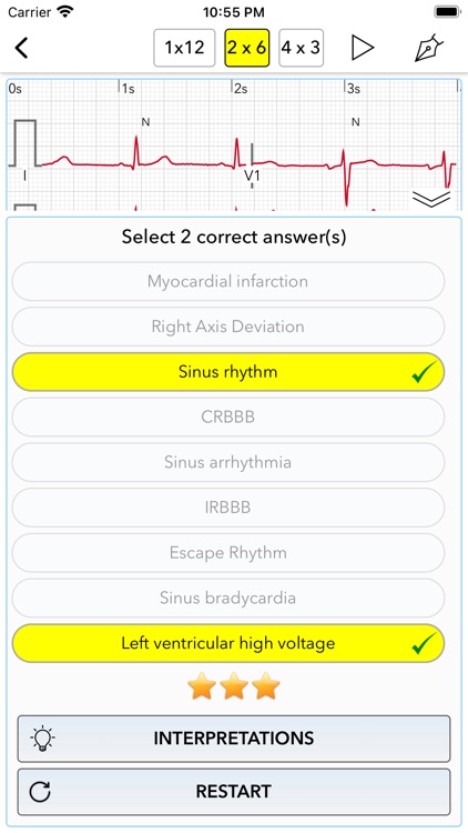 ECG Test Pro for Doctors screenshot-3