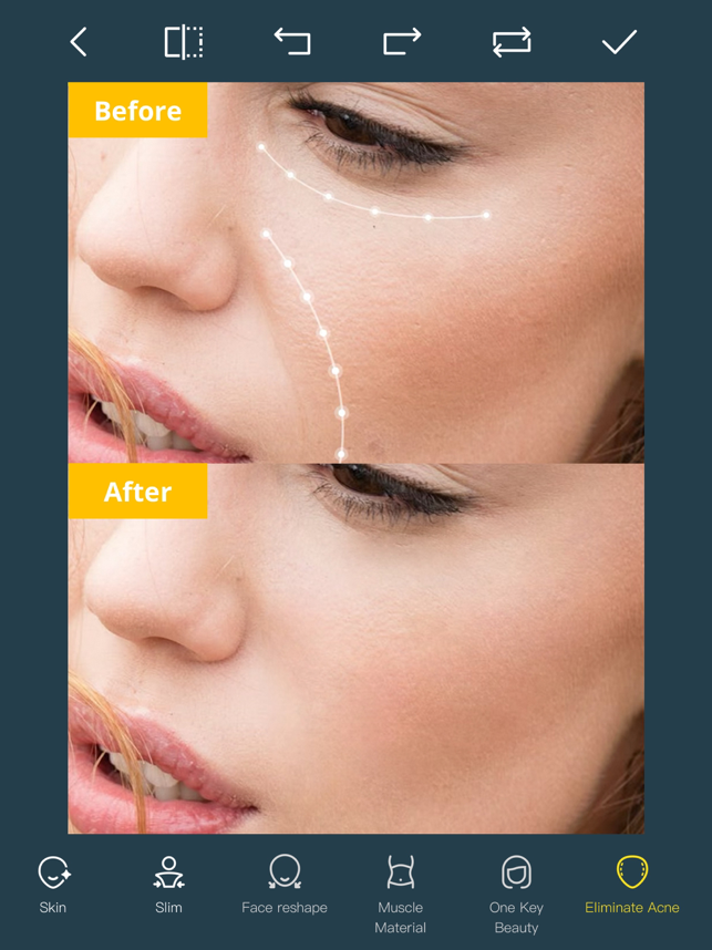 ‎Photo Retouch-Object Removal Screenshot