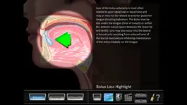 Game screenshot Oral Disorders mod apk