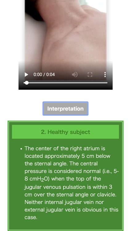 Pocket Heart Physical Exam