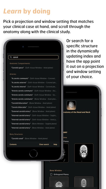 Radiology - Head&Neck Anatomy screenshot-3