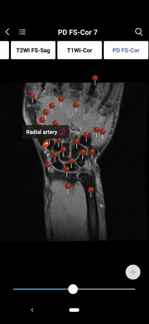 MedImaging-Radiology Made Easy(圖7)-速報App