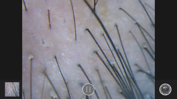 头皮毛发检测-新生活