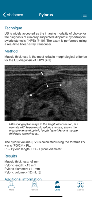 Radiology Measurements(圖7)-速報App