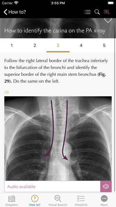 Chest X-ray Interpretation screenshot 4