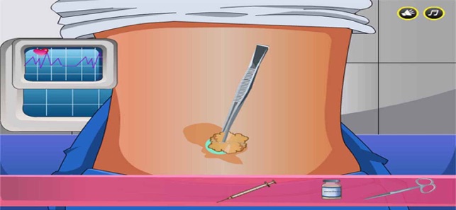 生二胎-剖腹产手术模拟器(圖4)-速報App