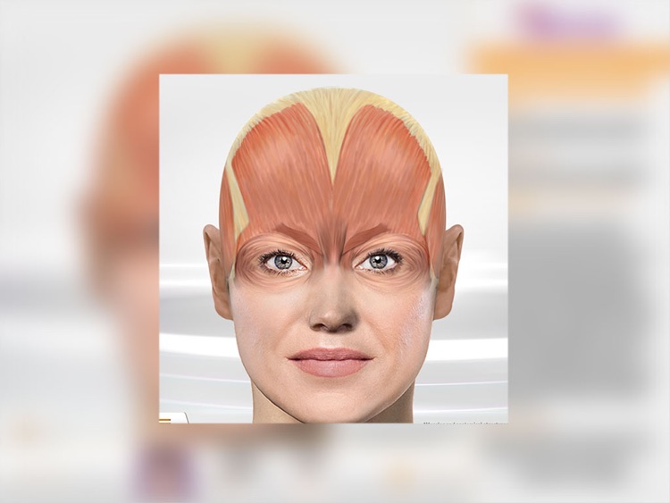 Chronic Migraine Anatomy