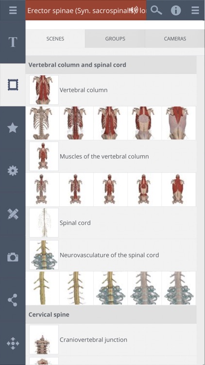 Spine: 3D Real-time