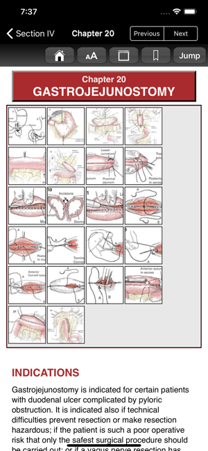 Zollinger Atlas of Surgery 10E(圖3)-速報App