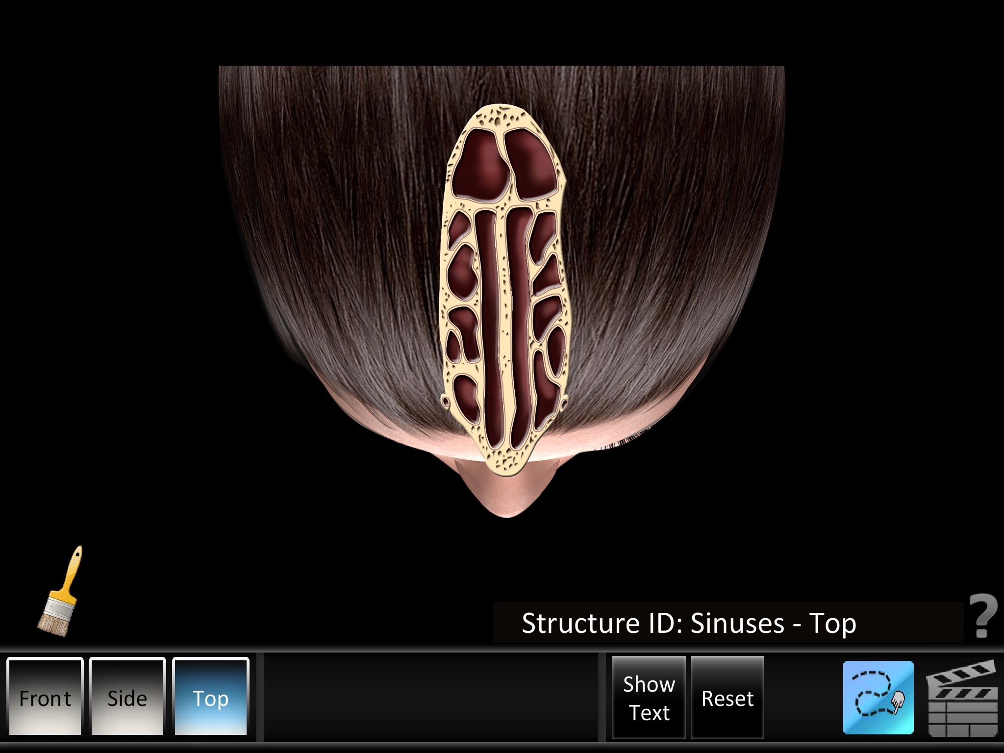 Sinus ID screenshot 3