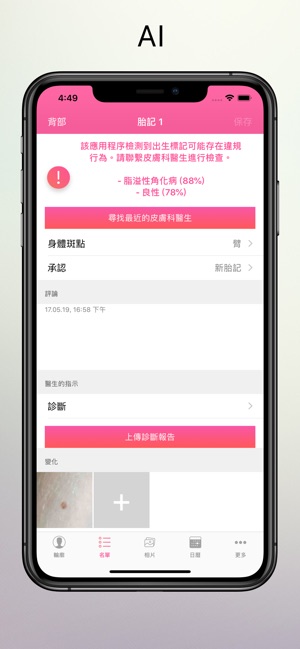 皮膚癌檢查(圖7)-速報App