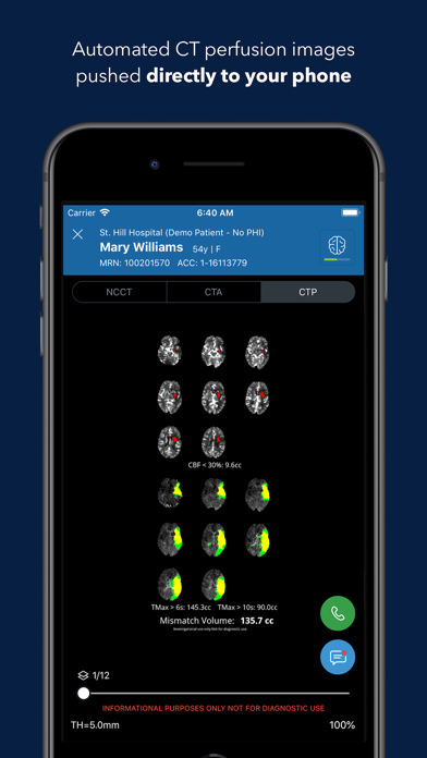 Viz Training AI Stroke Care screenshot 2