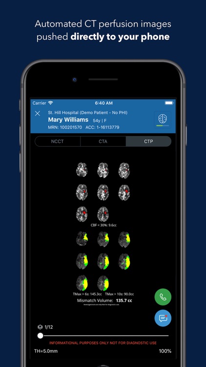 Viz Training AI Stroke Care