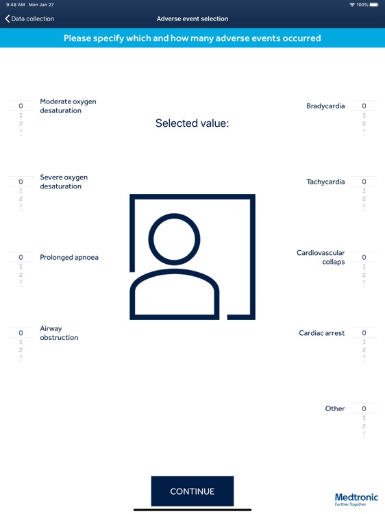 Microstream™ Sedation Data