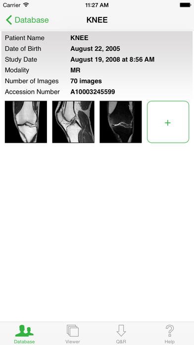 OsiriX HD Screenshot 4