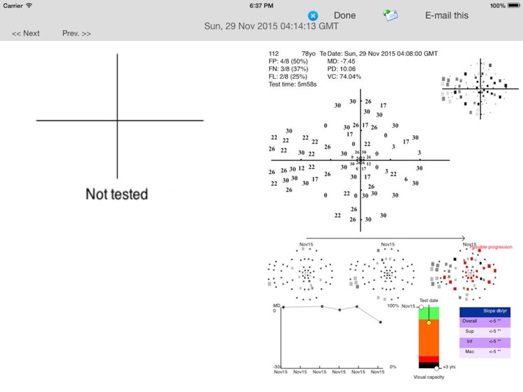 MRF Glaucoma screenshot-3