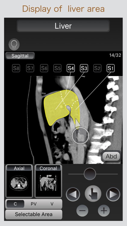 CT Passport Abdomen