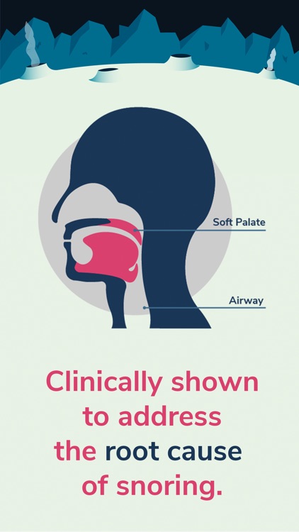 Soundly Reduce Snoring.