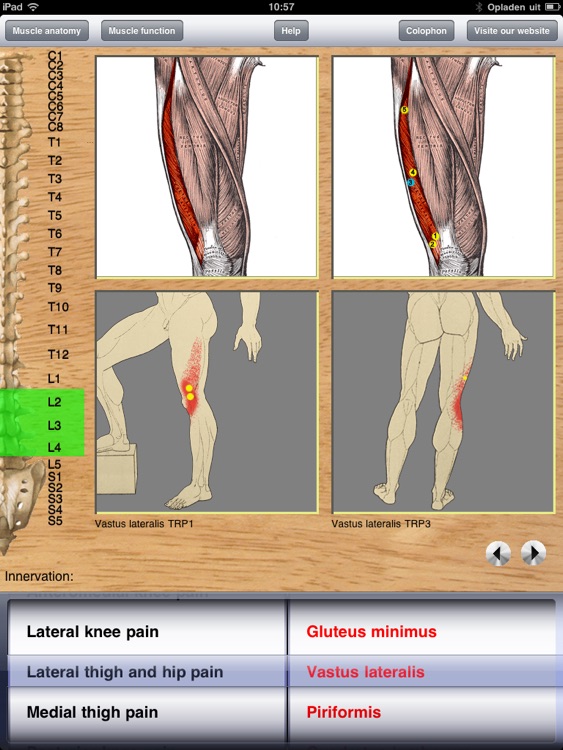 Dry Needling Pro