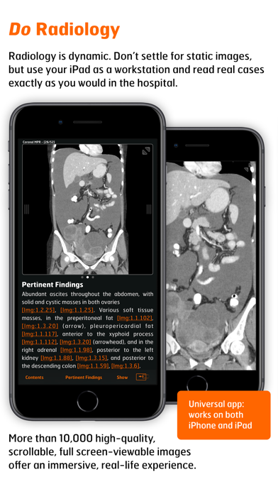 How to cancel & delete Radiology - Abdomen Dynamic from iphone & ipad 3