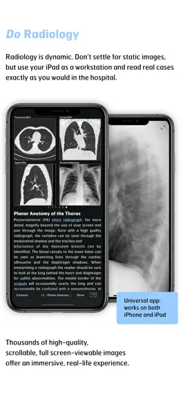 Game screenshot Radiology - Thoracic Imaging hack