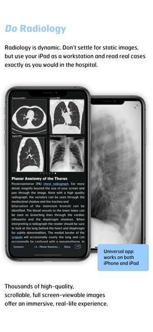 Radiology - Thoracic Imaging(圖3)-速報App