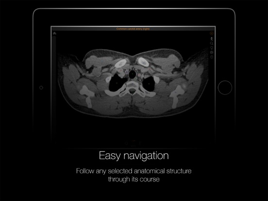 CT Anatomyのおすすめ画像5