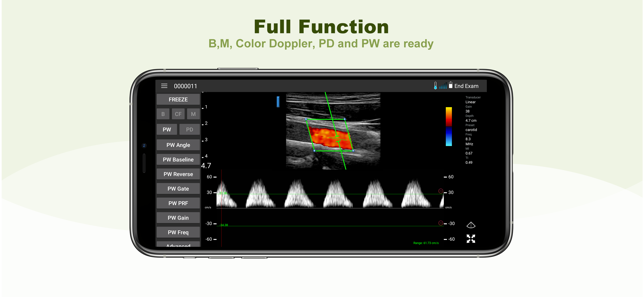 LELTEK Ultrasound(圖2)-速報App