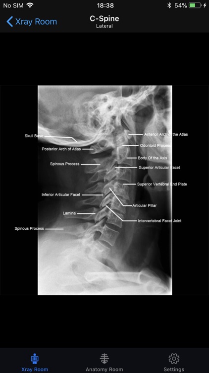 iRad Xrays