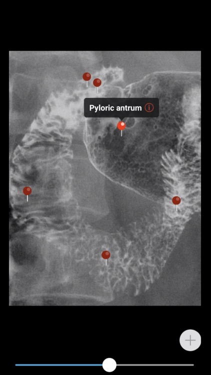 MedImaging-Radiology Made Easy screenshot-6