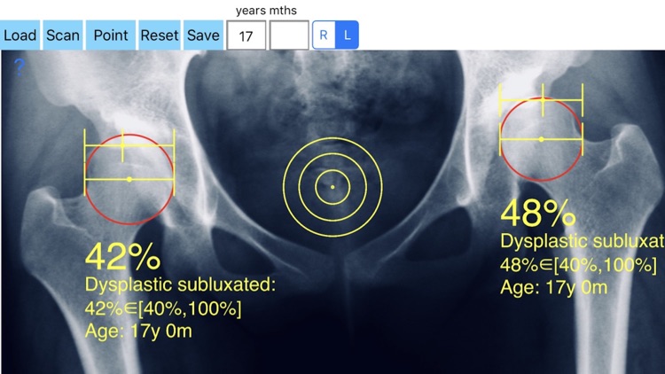 ReimersIndexApp screenshot-3