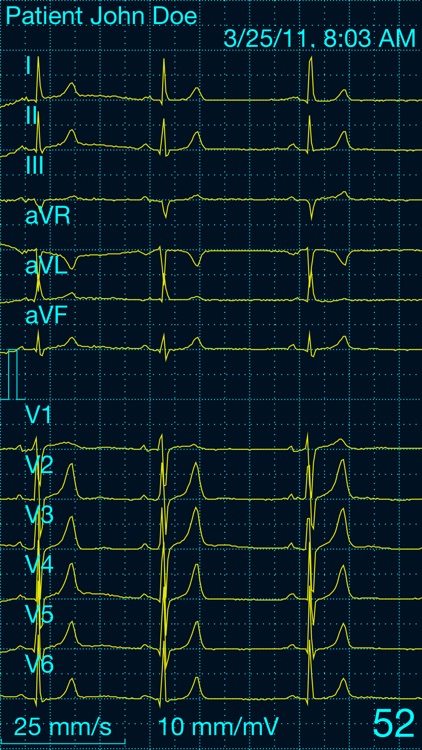 Cardiax