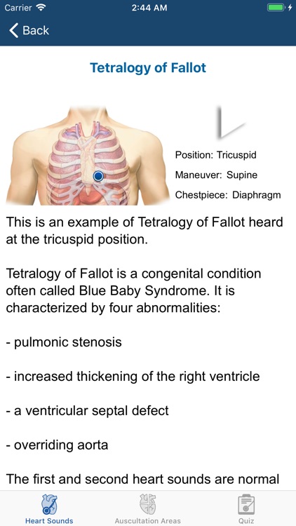 Heart Sounds Auscultation